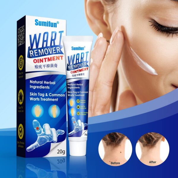 Wart Remover Ointment 20gm