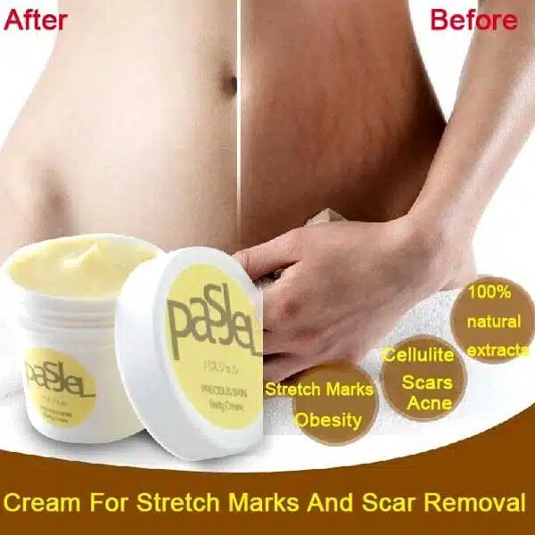 PASJEL STRETCHMARK REMOVAL CREAM