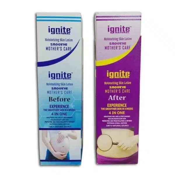 Ignite Mother care lotion-100 ML