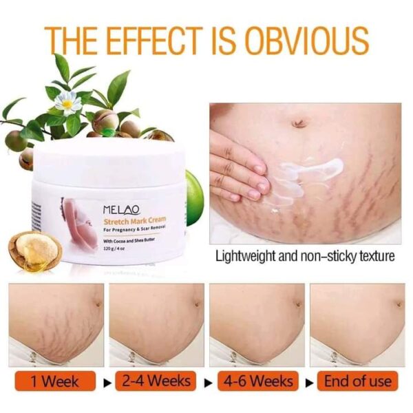 MELAO Stretch Mark Cream34