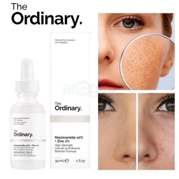 The Ordinary Niacinamide 10%+Zinc1% (30ml)